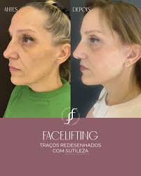 Dra. Franciele de Freitas