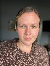 Cream that cleared up dry and scarred skin