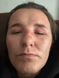 Seal Skin Covers Review: Poor Quality and Service