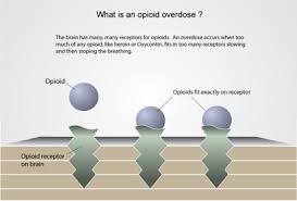 Image result for Opioid Overdose