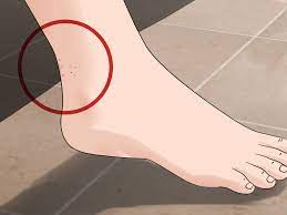 Fleas become most active when temperatures are favorable (35°c and a relative humidity of 70 percent are ideal conditions for flea. How To Detect Fleas 9 Steps With Pictures Wikihow