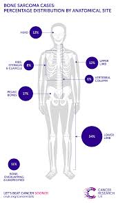 Cancer cells that have spread to the bone can damage the bone and cause symptoms. Bone Sarcoma Incidence Statistics Cancer Research Uk