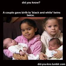 Black And White Identical Twins Alison Spooner Defied The Odds By Giving Birth To A Second Set Of Black And White Twin Girls Her Husband Is Black Doctors Say Birth Stories Twins Twin Girls