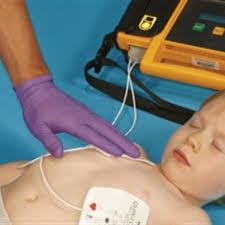 Un desfibrilador es un dispositivo que permite la aplicación de descargas eléctricas para lograr el restablecimiento del ritmo cardíaco normal. Como Se Usa Un Desfibrilador Externo Automatico Dea Healthychildren Org