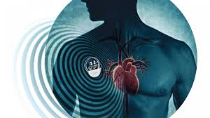 En su forma más grave (miocarditis eosinofílica miocarditis aguda o fulminante o en caso de empeoramiento brusco. Enfermedades Cardiovasculares Tratamiento De La Miocarditis