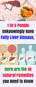 People Who Have Consumed Alcohol Heavily In Their Life Are At An Increased Risk Of Suffering From Liver Problems Fatty Liver Liver Disease Fatty Liver Disease