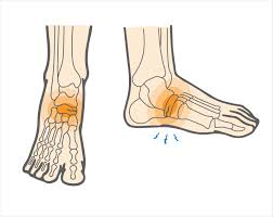What Is a Navicular Stress Fracture & How Can You Heal It?