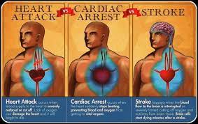Heart Attack Vs Cardiac Arrest Vs Stroke Coronary Heart Disease Cardiac Stroke Health