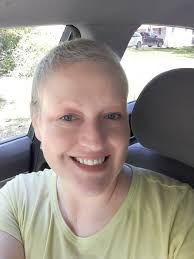 Breast Implant Associated