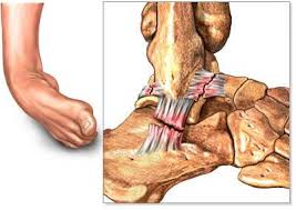 Pin On Meaty Muscles