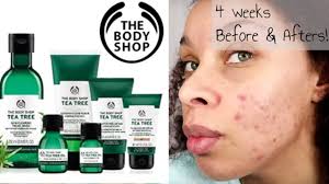 Tea tree is the only essential oil that you can apply directly on the skin without being diluted, which makes it very after cleansing and toning, massage two to three drops of the oil on to damp skin. The Bodyshop Tea Tree Line Review Acne Prone Skin Before Afters Youtube