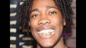 At seattle gold grills, our custom grillz are made to fit via our mold kit process which attains an exact impression of your teeth. Atlanta Custom Gold Grills Youtube