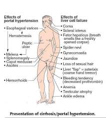 Pin On Liver