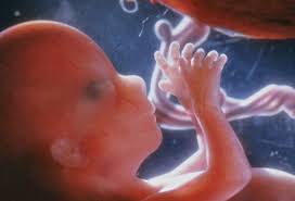 Most women get symptoms in. Ectopic Pregnancy Signs Symptoms Causes Surgery Test
