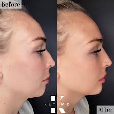 Keys MD Cosmetic Clinic