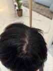 مركز لافي كلينك للتجميل وازالة الشعر الزائد بالليزر