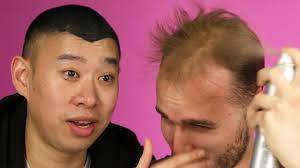 Male pattern baldness follows a predictable pattern. Balding Men Try Spray On Hair Youtube