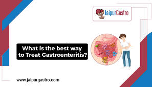 Gastroenteritis is a common condition that triggers diarrhoea, sickness and tummy pain. What Is The Best Way To Treat Gastroenteritis Jaipurgastro