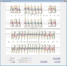 Perio Charting Bismi Margarethaydon Com