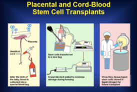 Since then, over 1 million cord blood units have been collected and stored in public and family banks all over the. Cord Blood Banking By Tiankai Zhang Openwetware