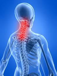 You may be able to do something about it. Neck Pain Center Houston Neurosurgery Spine