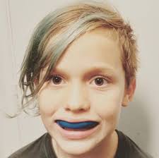 The softened plastic molds to the shape of your teeth, giving a more customized fit than. How To Mold Sports Mouth Guard Step By Step Mouthguard Fitting Instructions Oral Mart Mouthguards