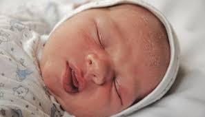 Image result for yellow scabs on the face in children