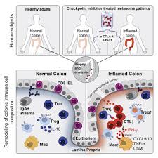 Colon synonyms, colon pronunciation, colon translation, english dictionary definition of colon. Molecular Pathways Of Colon Inflammation Induced By Cancer Immunotherapy Sciencedirect