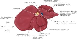 Called also broad ligament of liver. Falciform Ligament An Overview Sciencedirect Topics