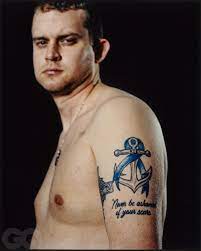 Excluding skin cancers, colorectal cancer is the 3rd most common cancer diagnosed in both men and women in the united states and is the 2nd leading cause of cancer related deaths among men. Scar Stories The Toll Of Colon Cancer Gq