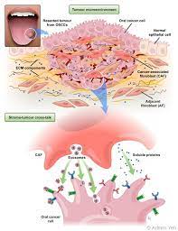Aide de la caf/msa : Molecular Basis For Tongue Cancer Progression