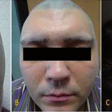 Husein HUSEIN-ELAHMED