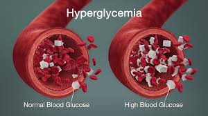 Awas 14 Amaran Awal Tanda Gula Dalam Darah Anda Tinggi. Ini Panduan Makanan  Jaga Paras Gula. - Hijabista
