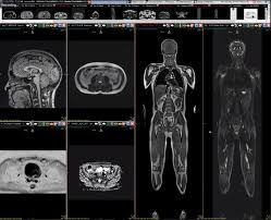 The brain mri cost $875.00 without contrast. The Latest Quantified Self Trend Whole Body Mri