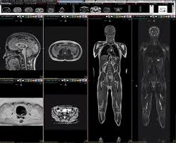 Mri scan may or may not use contrast medias. The Latest Quantified Self Trend Whole Body Mri