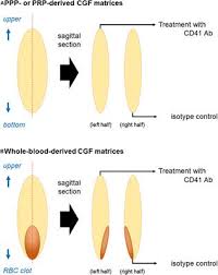 A simplified chair side procedure results in the production of a fibrin membrane that is. Frontiers Concentrated Growth Factor Matrices Prepared Using Silica Coated Plastic Tubes Are Distinguishable From Those Prepared Using Glass Tubes In Platelet Distribution Application Of A Novel Near Infrared Imaging Based Quantitative Technique