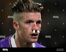 Bolton Wanderers' Reece Burke with nose bleed Stock Photo