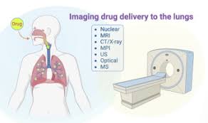 Image result for Pulmonary Intoxicant