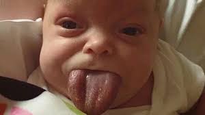 Impact of Growth Hormones