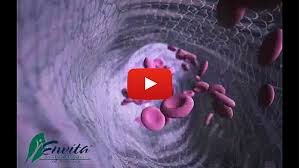 When cancer spreads far from its original. Stage 4 Cancer Approaches That Really Matter Envita Medical Center