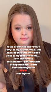 We didn't know Grace would have Down syndrome. I'll never forget when she  was born; the doctor took her swiftly and didn't speak to us for what  seemed like an eternity. When