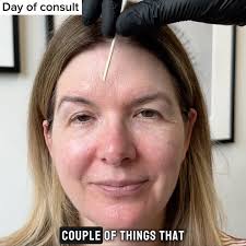 Dr. Babak Maleki, Oculoplastic Surgeon