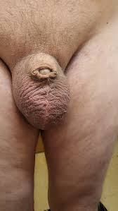 Castrated penis | MOTHERLESS.COM ™