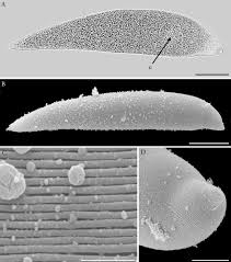 Image result for Lankesteria