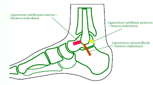 Osg Banderriss Ogam Orthopadie