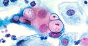 Pap smears usually are done as part of regular pelvic exams. Easier Less Invasive Std Test May Be An Overlooked Winner Scienceline