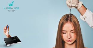 Hair loss treatment has become an increasingly popular trend in europe over the last few years. The Difference Between Hair Transplantation And Plasma Injection Natural Hair Turkey