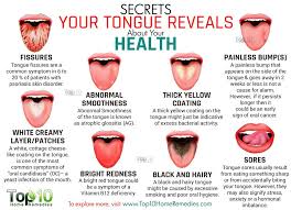 10 Secrets Your Tongue Reveals About Your Health Top 10 Home Remedies Tongue Health Health Tips Health Remedies