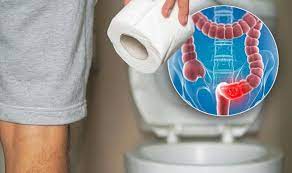 Dark red or maroon blood can mean that you have bleeding higher in the colon or in the small bowel. Bowel Cancer Symptoms Signs Of A Tumour In The Toilet And Stools Include Blood In Poo Express Co Uk