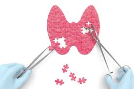 Nadczynność jest jedną z częściej występującyh zaburzeń pracy tarczycy, wymaga. Nadczynnosc Tarczycy Co To Za Choroba I Jak Sie Ja Leczy Ktomalek